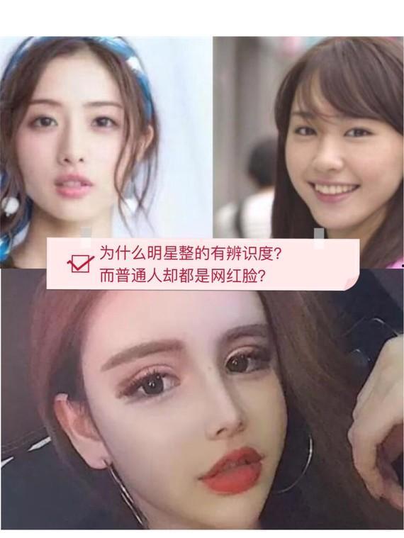明星网红整容区别,揭秘两者美容术的异同