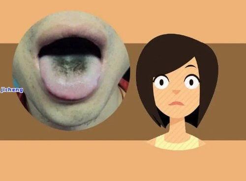 吃瓜后舌头黑怎么回事啊,揭秘口腔健康小常识