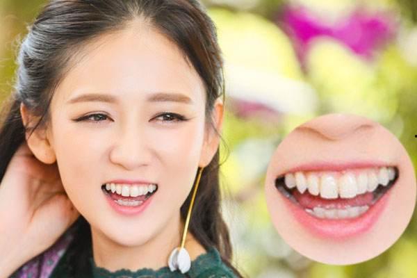 HR明星网红美齿,HR明星网红的明星美齿养成记